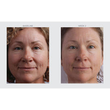 Load image into Gallery viewer, STP Duo