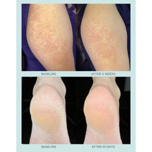 Load image into Gallery viewer, Dual Action Smoothie