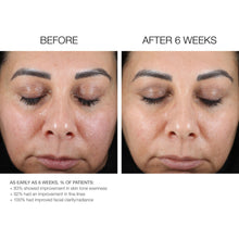 Load image into Gallery viewer, Advanced Retinol Serum 5X
