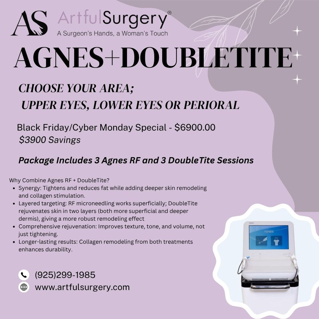 Agnes + DoubleTite- Black Friday/Cyber Monday Deal