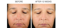 Load image into Gallery viewer, Powerhouse Retinol Serum 10X- (must be purchased in office)
