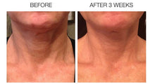 Load image into Gallery viewer, Neck Lift Smoothie
